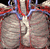 Lung Anatomy Pictures